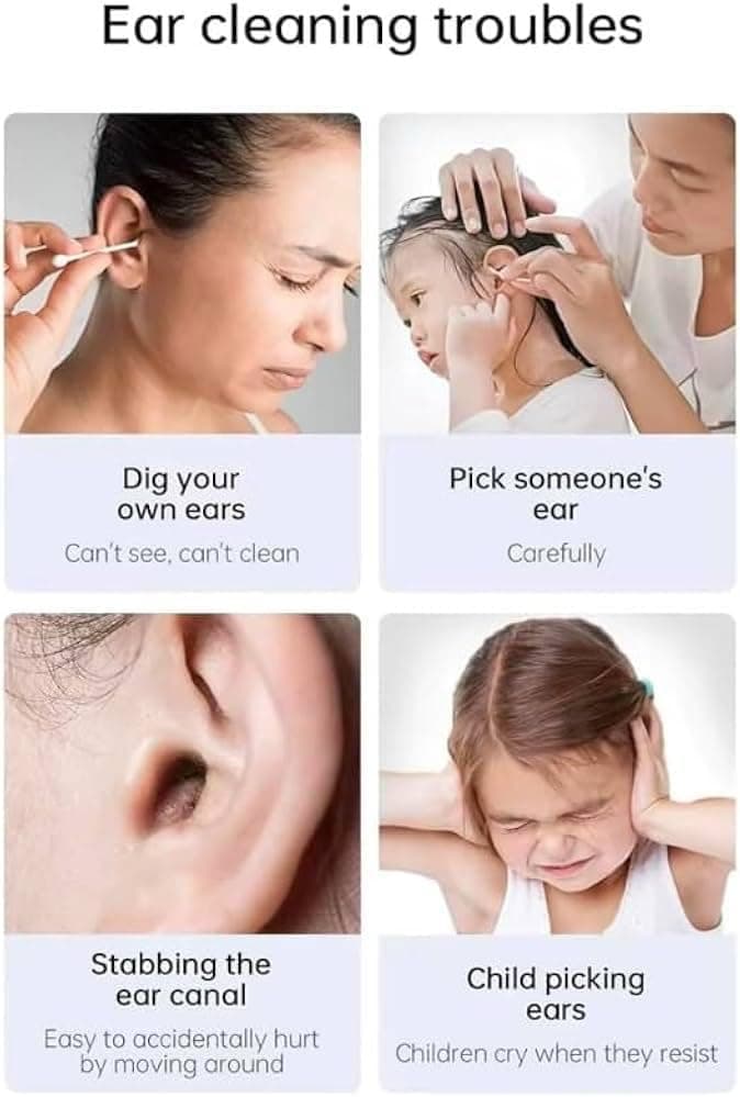 ابزار پاککننده جرم گوش با دوربین HD – شامل دوربین، ۶ چراغ LED، و ابزار تمیزکننده گوش، کیف کامل پاکسازی جرم گوش، شارژ از طریق USB و سازگار با Android و iPhone – رنگ مشکی.